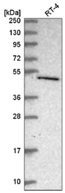 C7orf26 Antibody, Novus Biologicals 100&mu;L; Unlabeled:Antibodies, Polyclonal