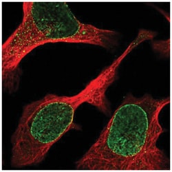 ZBED6 C-Terminal Like Antibody, Novus Biologicals 25 &mu;L:Antibodies,