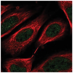 C8orf44 Antibody, Novus Biologicals 25 &mu;L:Antibodies, Polyclonal