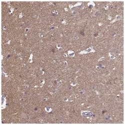 Ferric Chelate Reductase 1 Like Antibody, Novus Biologicals:Antibodies:Primary
