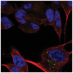 CACNA2D2 Antibody, Novus Biologicals 25 &mu;L, Unlabeled:Antibodies, Polyclonal