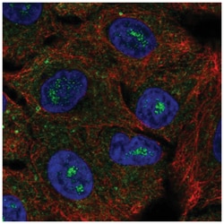 CACNG6 Antibody, Novus Biologicals 100&mu;L; Unlabeled:Antibodies, Polyclonal