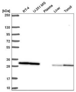 CACYBP Antibody, Novus Biologicals:Antibodies:Primary Antibodies