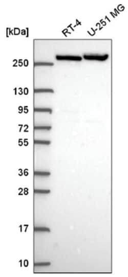 CAD Antibody, Novus Biologicals 25 &mu;L, Unlabeled:Antibodies, Polyclonal