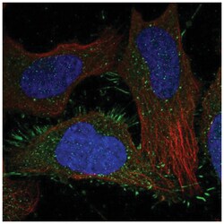 CRLR Antibody, Novus Biologicals:Antibodies:Primary Antibodies