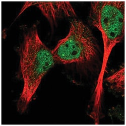 Calpain 10 Antibody, Novus Biologicals 100&mu;L; Unlabeled:Antibodies,