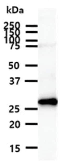 Calretinin Mouse anti-Human, Clone: 5C5, Novus Biologicals:Antibodies:Primary