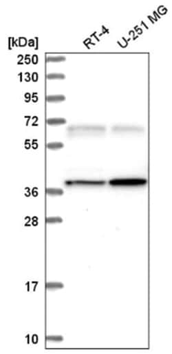 CaM Kinase II gamma Antibody, Novus Biologicals 25 &mu;L, Unlabeled:Antibodies,