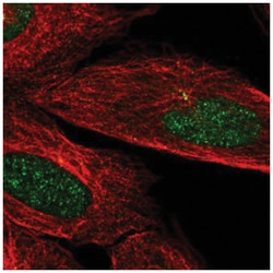 CaMKIIN2 Antibody, Novus Biologicals:Antibodies:Primary Antibodies