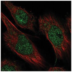 CAMTA2 Antibody, Novus Biologicals 100&mu;L; Unlabeled:Antibodies, Polyclonal