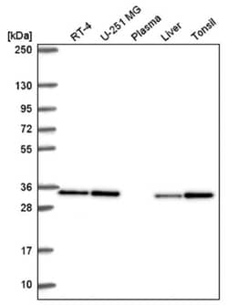 CAPZB Antibody, Novus Biologicals 100&mu;L; Unlabeled:Antibodies, Polyclonal