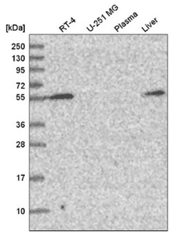 Carbohydrate Sulfotransferase 3/CHST3 Antibody, Novus Biologicals 25 &mu;L,