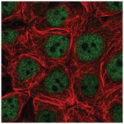 Carm1 Antibody, Novus Biologicals 100&mu;L; Unlabeled:Antibodies, Polyclonal