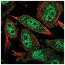 Carm1 Antibody, Novus Biologicals:Antibodies:Primary Antibodies