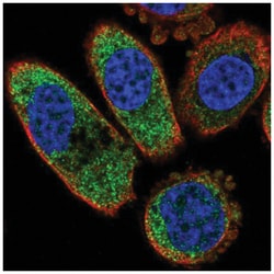 Casein Kinase 1 alpha Antibody, Novus Biologicals:Antibodies:Primary Antibodies