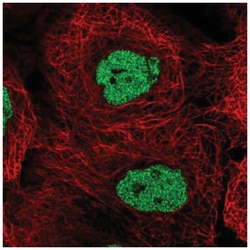Casein Kinase 2 alpha Antibody, Novus Biologicals:Antibodies:Primary Antibodies
