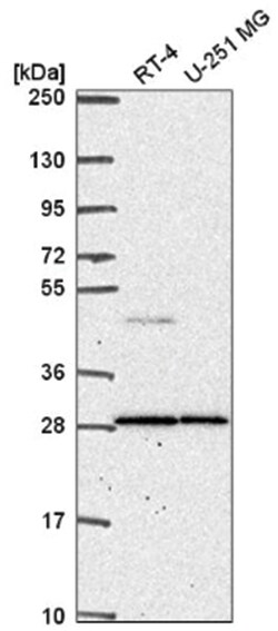 Cathepsin C/DPPI Antibody, Novus Biologicals 25 &mu;L:Antibodies, Polyclonal