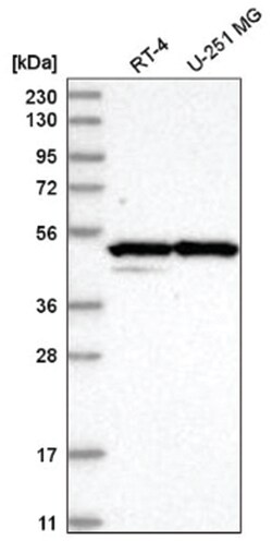 CBARA1 Antibody, Novus Biologicals:Antibodies:Primary Antibodies