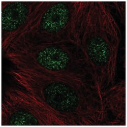 CBFA2T3 Antibody, Novus Biologicals 25 &mu;L:Antibodies, Polyclonal