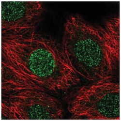 CBFA2T3 Antibody, Novus Biologicals:Antibodies:Primary Antibodies