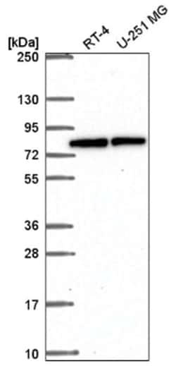 CBFA2T3 Antibody, Novus Biologicals:Antibodies:Primary Antibodies