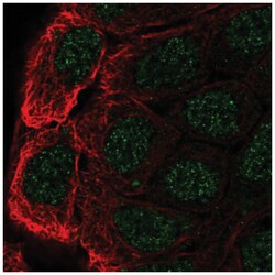 Cbl-c Antibody, Novus Biologicals 100&mu;L; Unlabeled:Antibodies, Polyclonal