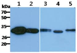 CBR1 Mouse anti-Human, Clone: 2D6, Novus Biologicals:Antibodies:Primary
