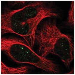 CBX4 Antibody, Novus Biologicals:Antibodies:Primary Antibodies
