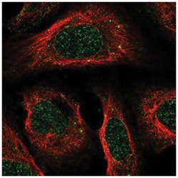 CC Chemokine Receptor D6 Antibody, Novus Biologicals 25 &mu;L, Unlabeled:Antibodies,