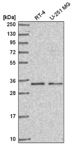 CCDC107 Antibody, Novus Biologicals 100&mu;L; Unlabeled:Antibodies, Polyclonal