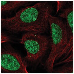 CCDC12 Antibody, Novus Biologicals 100&mu;L; Unlabeled:Antibodies, Polyclonal