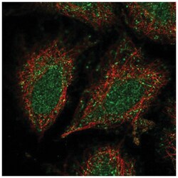 CCDC122 Antibody, Novus Biologicals:Antibodies:Primary Antibodies