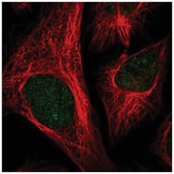 CCDC147 Antibody, Novus Biologicals:Antibodies:Primary Antibodies