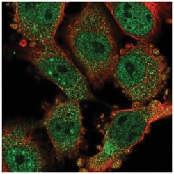 CCDC159 Antibody, Novus Biologicals 25 &mu;L:Antibodies, Polyclonal