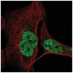 CCDC188 Antibody, Novus Biologicals 100&mu;L; Unlabeled:Antibodies, Polyclonal