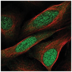 CCDC3 Antibody, Novus Biologicals 100&mu;L; Unlabeled:Antibodies, Polyclonal