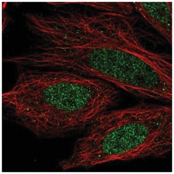CCDC36 Antibody, Novus Biologicals 25 &mu;L, Unlabeled:Antibodies, Polyclonal