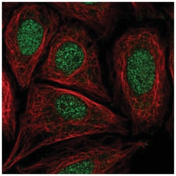 CCDC61 Antibody, Novus Biologicals 25 &mu;L, Unlabeled:Antibodies, Polyclonal