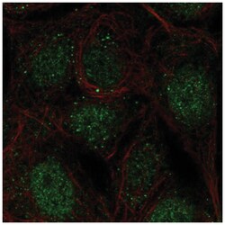 CCDC63 Antibody, Novus Biologicals 25 &mu;L, Unlabeled:Antibodies, Polyclonal