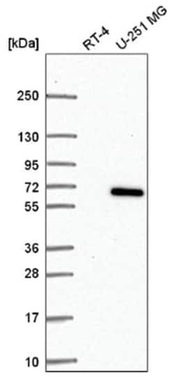 CCDC64 Antibody, Novus Biologicals 25 &mu;L, Unlabeled:Antibodies, Polyclonal