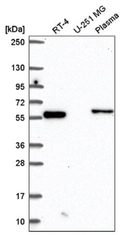 CCDC65 Antibody, Novus Biologicals 100&mu;L; Unlabeled:Antibodies, Polyclonal