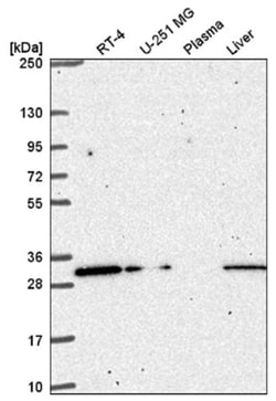 CCDC69 Antibody, Novus Biologicals 25 &mu;L | Buy Online | Novus Biologicals | Fisher Scientific