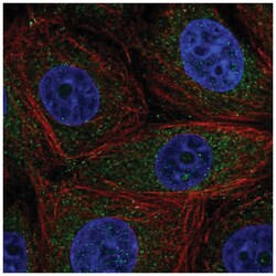 CCDC9 Antibody, Novus Biologicals 25 &mu;L, Unlabeled:Antibodies, Polyclonal