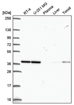 CCDC94 Antibody, Novus Biologicals 100&mu;L; Unlabeled:Antibodies, Polyclonal