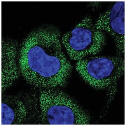 CCHCR1 Antibody, Novus Biologicals:Antibodies:Primary Antibodies