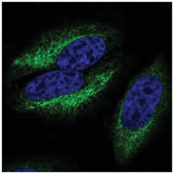 CCR10/GPR2 Antibody, Novus Biologicals:Antibodies:Primary Antibodies