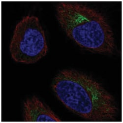 CCR10/GPR2 Antibody, Novus Biologicals 100&mu;L; Unlabeled:Antibodies,