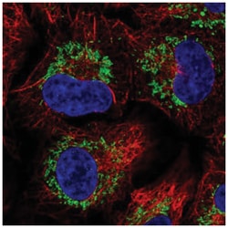 CCR7 Antibody, Novus Biologicals 25 &mu;L, Unlabeled:Antibodies, Polyclonal