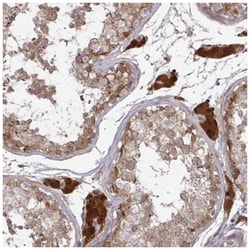 CCS/SOD4 Antibody, Novus Biologicals:Antibodies:Primary Antibodies