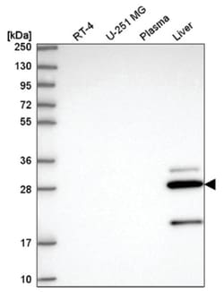CCS/SOD4 Antibody, Novus Biologicals 25 &mu;L, Unlabeled:Antibodies, Polyclonal